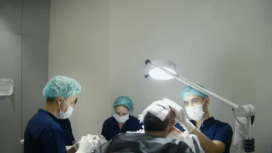 زراعة الشعر في اسطنبول 2026